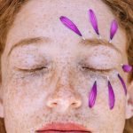 Tratamiento HIFU 12D Ultra-lifting en cara, cuello y papada con radiofrecuencia